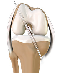 Knee Image Knee