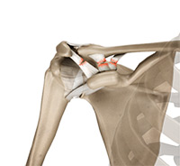Sports Medicine Image Sports Medicine