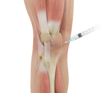 Knee Image Knee