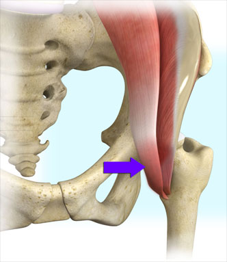 Iliopsoas Release