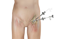 Hip Image Hip