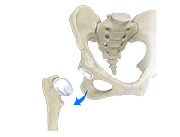 Hip Image Hip