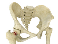 Hip Image Hip