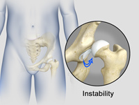 Hip Image Hip