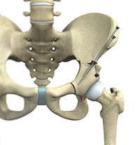 Hip Image Hip