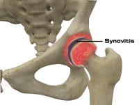 Hip Image Hip