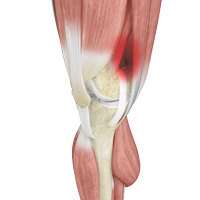 Knee Image Knee