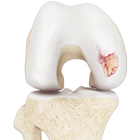 Knee Image Knee
