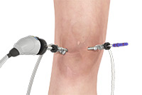Knee Image Knee