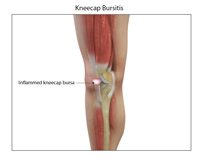 Knee Image Knee