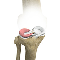 Knee Image Knee