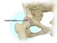 Hip Image Hip