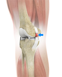 Knee Image Knee