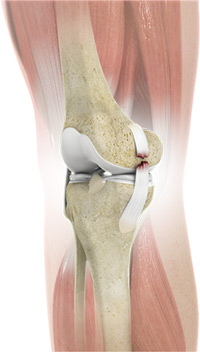 Knee Image Knee