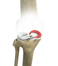 Knee Image Knee