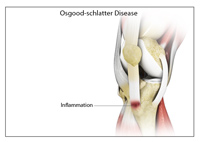 Knee Image Knee
