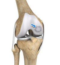 Knee Image Knee