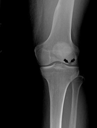 Knee Image Knee
