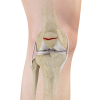 Knee Image Knee