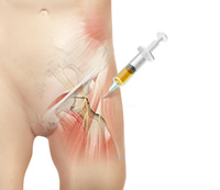 Hip Image Hip