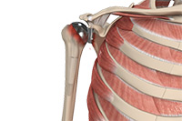 Sports Medicine Image Sports Medicine