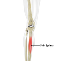 Knee Image Knee