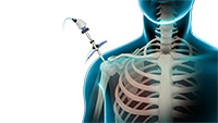 Shoulder and Elbow Image Shoulder and Elbow