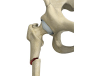 Hip Image Hip
