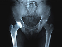 Hip Image Hip