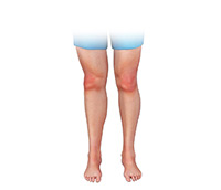 Knee Image Knee