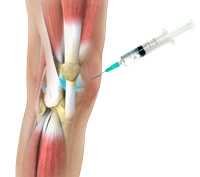 Knee Image Knee