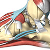 Sprains/Strains